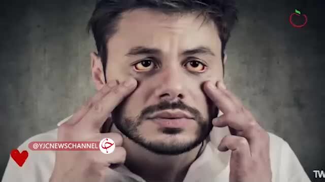 ببینید | انواع سر درد را بشناسید