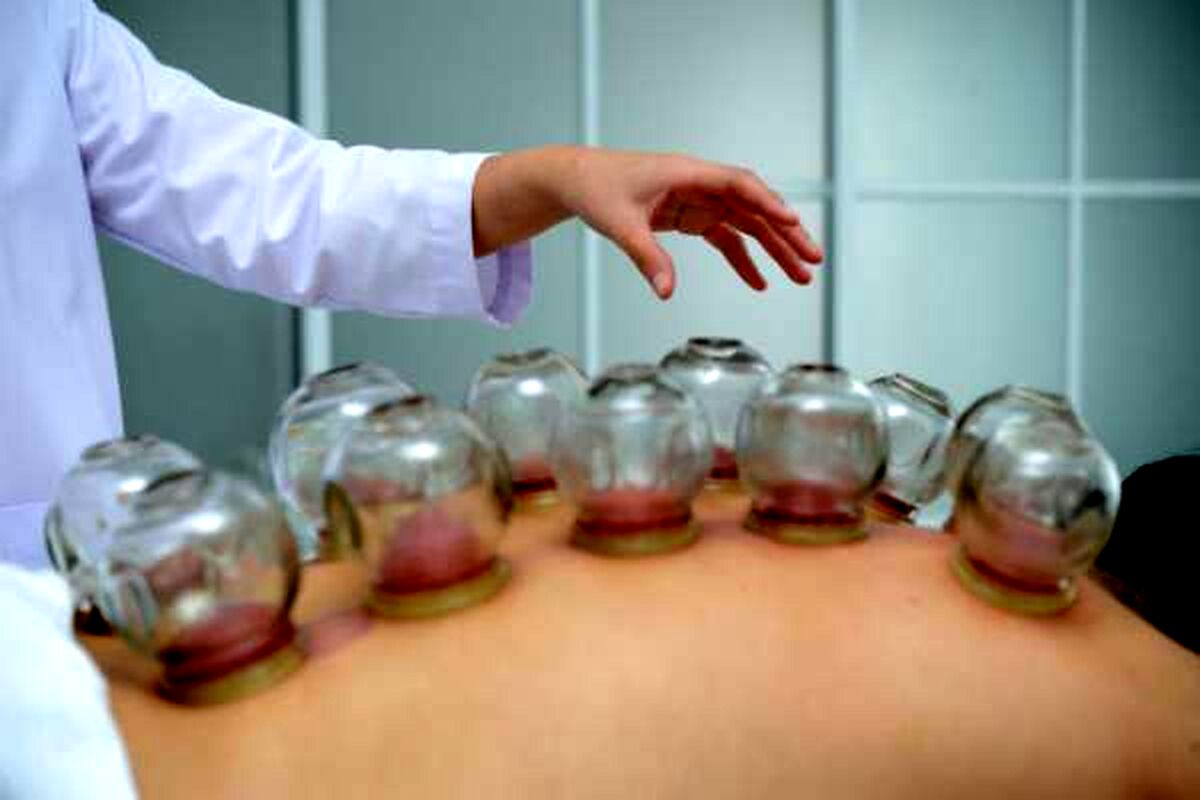 این افراد در فصل بهار نباید حجامت کنند