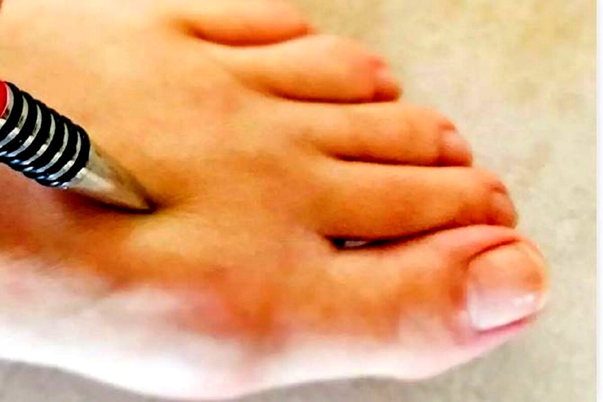 کاهش فشار خون  با یک خودکار تو یک چشم بهم زدن | سریعترین روش کاهش فشار خون در خانه