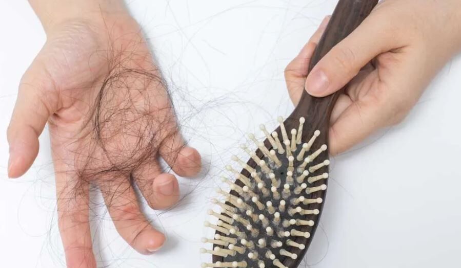 چه مقدار ریزش مو طبیعی است؟! + ویدئو