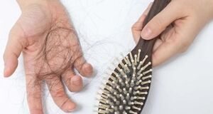 چه مقدار ریزش مو طبیعی است؟! + ویدئو