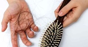 چه مقدار ریزش مو طبیعی است؟! + ویدئو