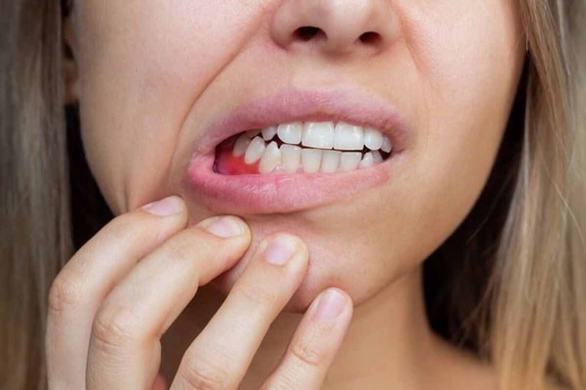علت تغییر رنگ لثه‌ ها چیست؟