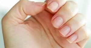 ایا قارچ ناخن دست خطرناک است؟ | درمان قارچ ناخن در منزل به سادگی