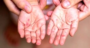 ویدئو | آخرین وضعیت تب برفکی در کشور