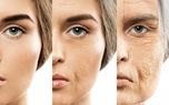 ترفندهای فوق العاده برای رفع چین و چروک پوست صورت