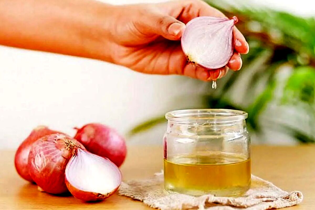 قطعی ریزش موی سکه‌ای با آب این صیفی
