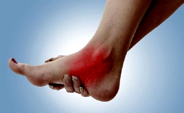 چرا پاهایتان سرد است؟ | دلایل مهم علت سردی پا