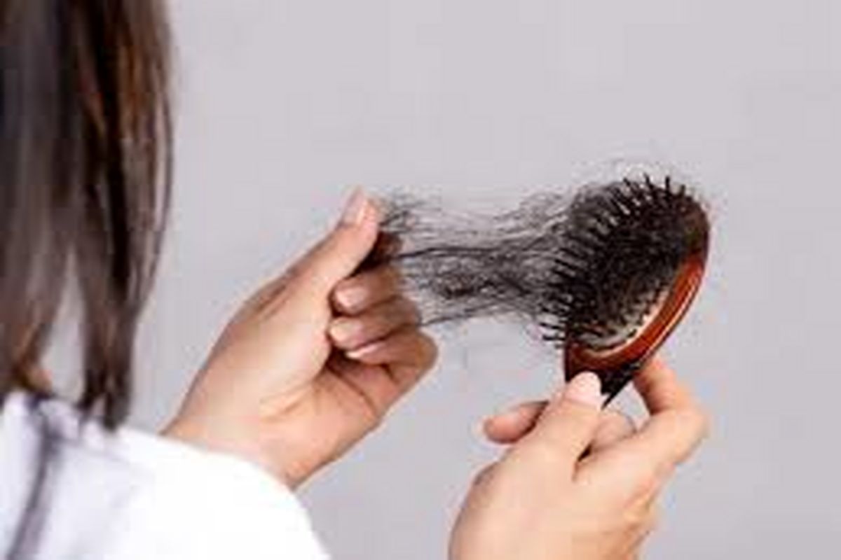 درمان ریزش مو به جدیدترین روش  | راهکارهای جلوگیری از ریزش مو