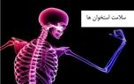 علائم شروع پوکی استخوان + درمان